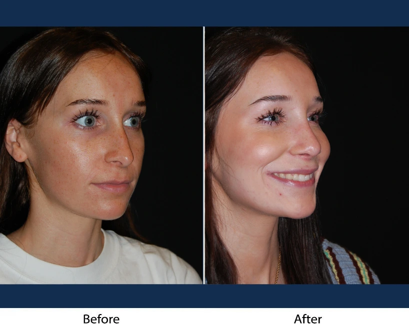 Only Faces Template - 2024-12-20T193435.608