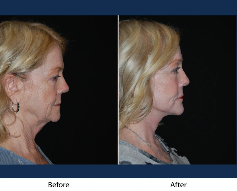 Only Faces Template - 2025-01-07T135930.199