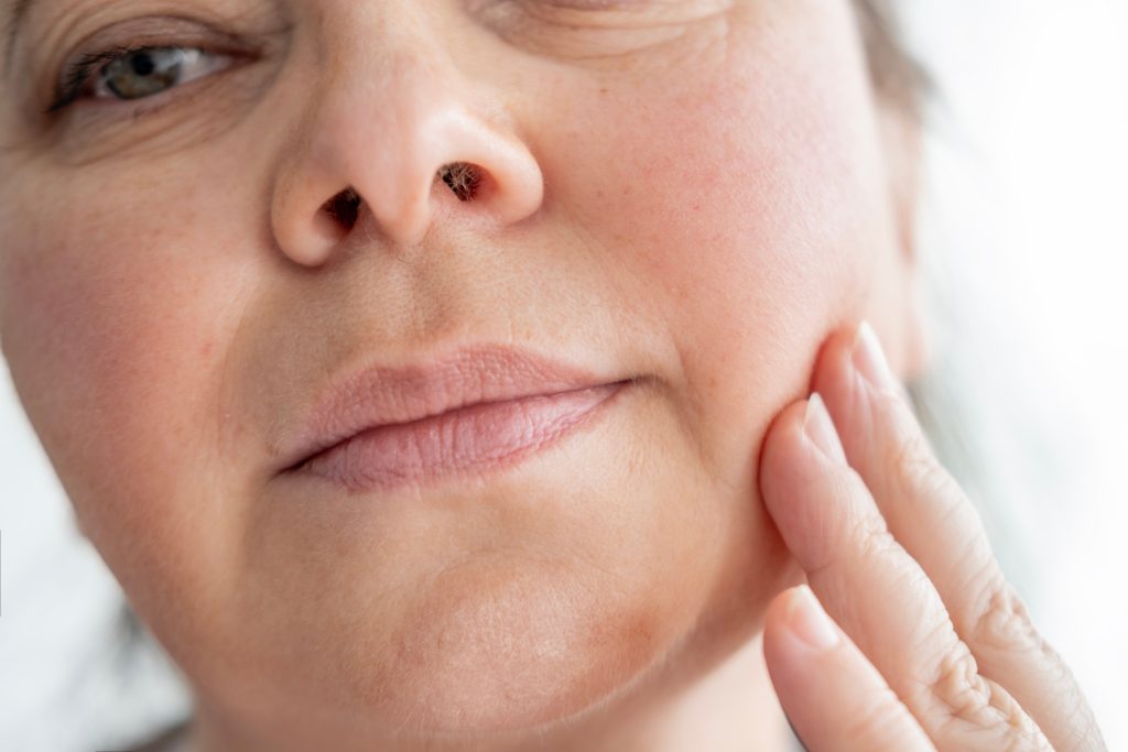 What Causes Jowls? And Why a Facelift Can Correct Them Banner