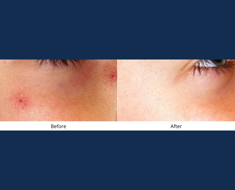 Only Faces Template - 2024-09-03T114248.118