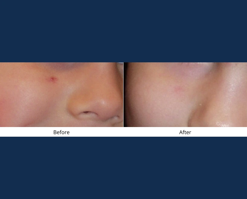 Only Faces Template - 2024-09-03T115205.175