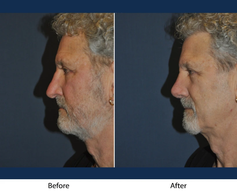 Only Faces Template (76)