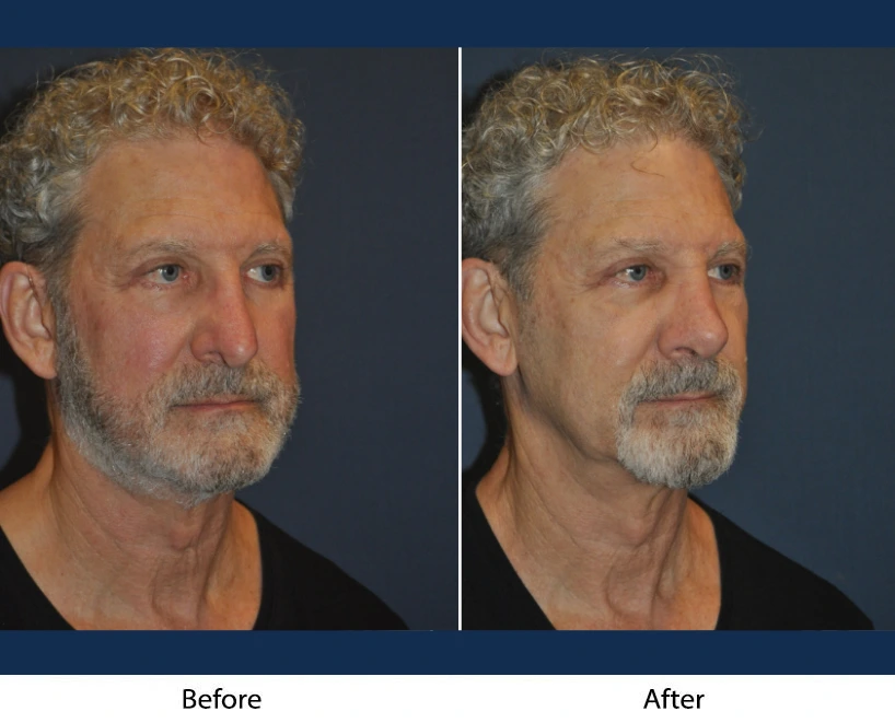 Only Faces Template (77)