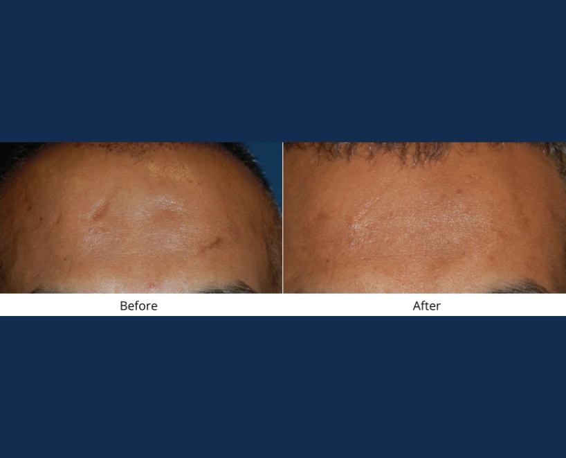 Only Faces Template (87)