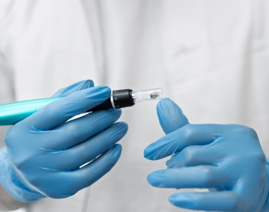 Microneedling in Portland