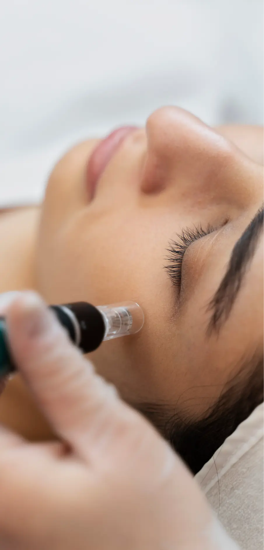 Microneedling Portland uses