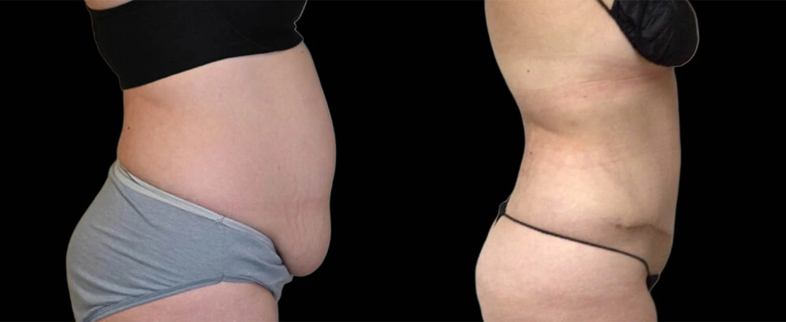 0001_RIGHT-LATERAL-VIEW-BA.jpg