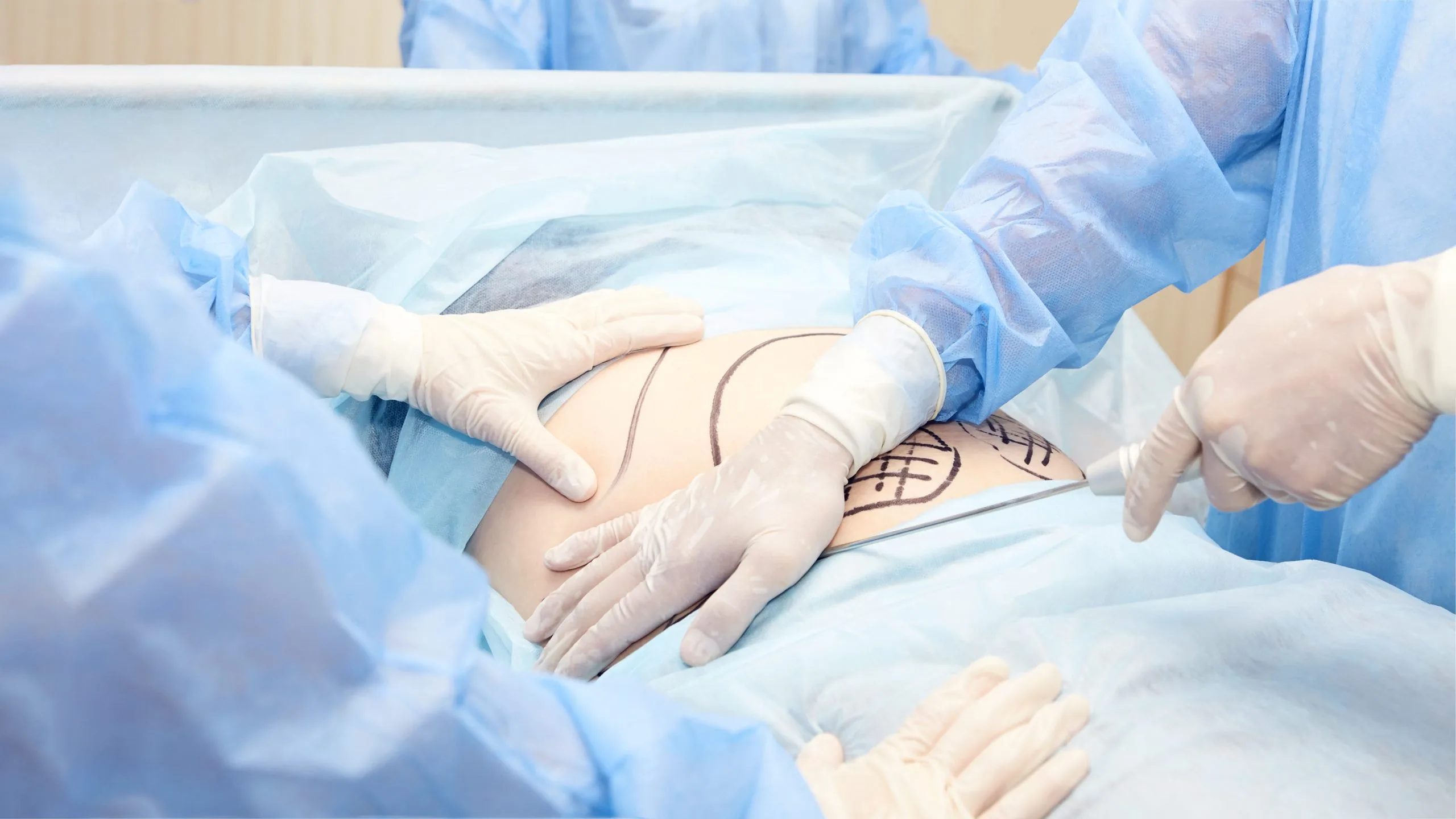 Can You Combine a Tummy Tuck With Other Procedures? Risks And Recovery Timeline Banner