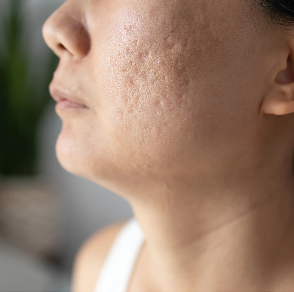 Close-up of woman's face showing skin texture in profile