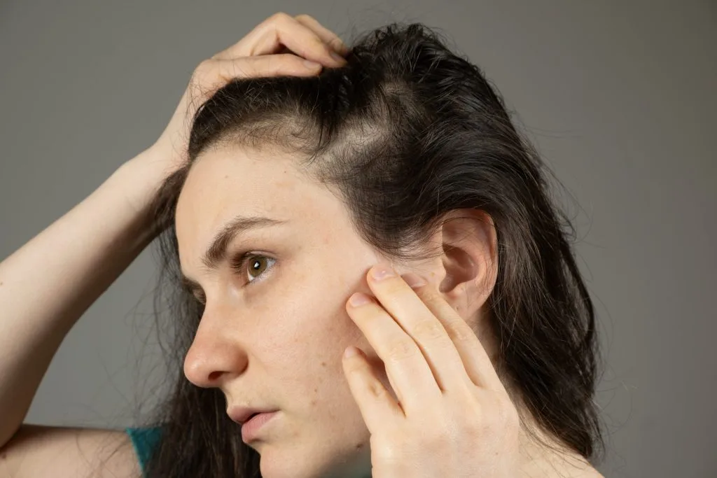 Woman examining a thinning hair patch at her temple