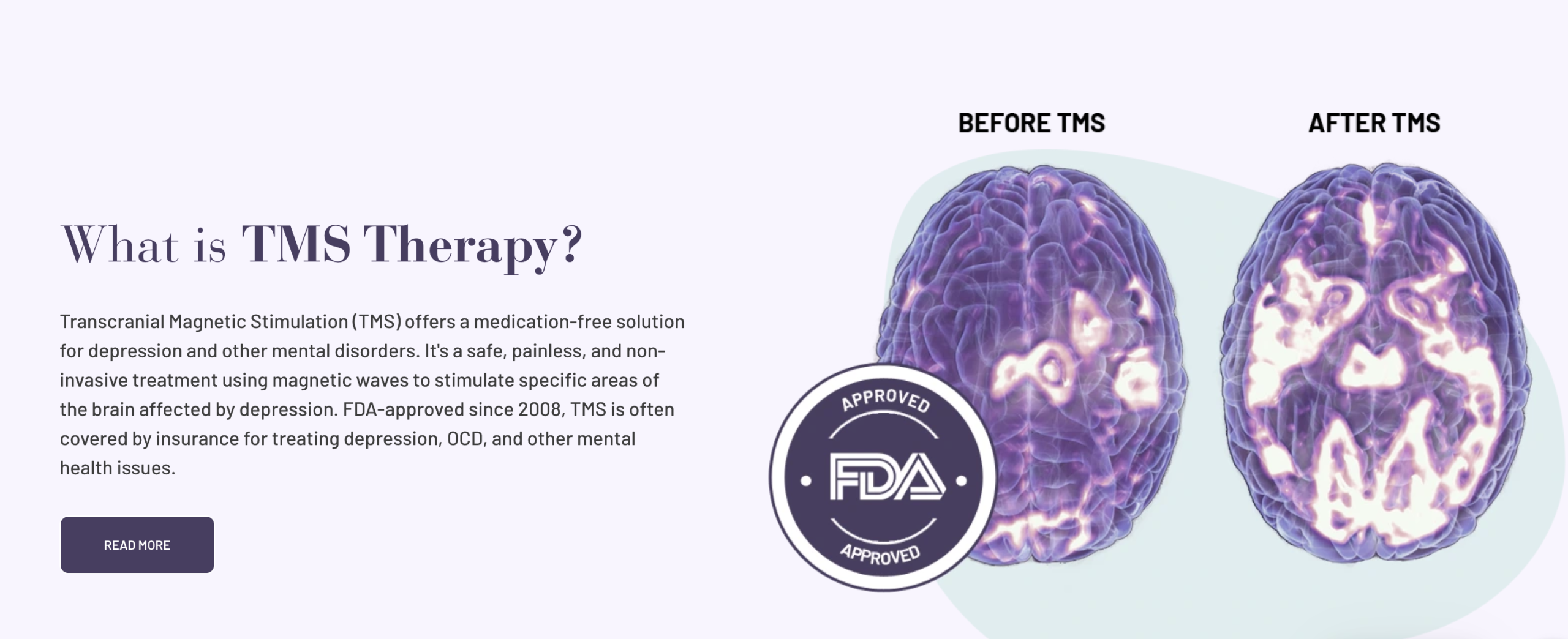 marketing strategy for tms clinics