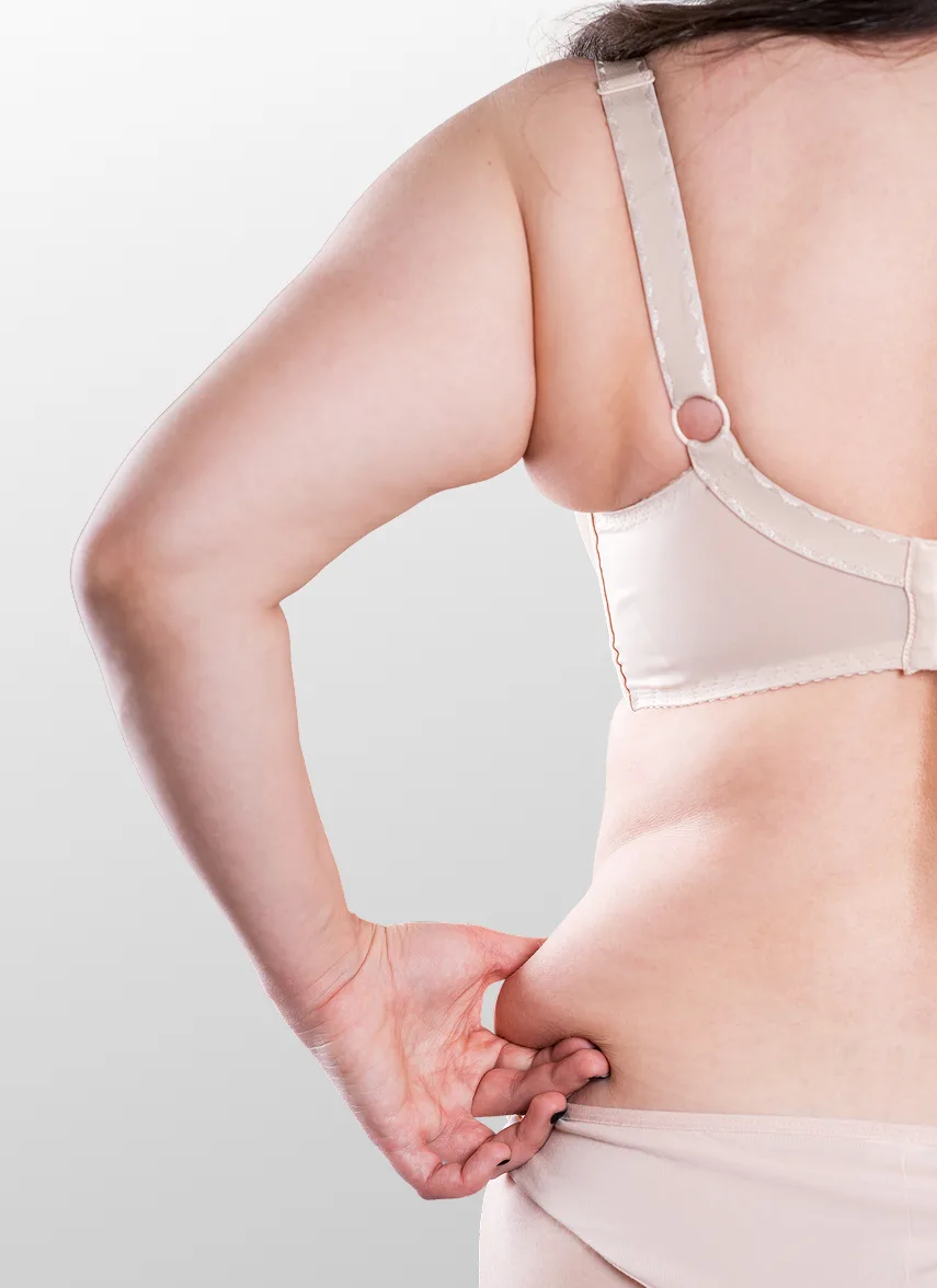 Woman showing loose skin on abdomen and arms, demonstrating body lift candidacy