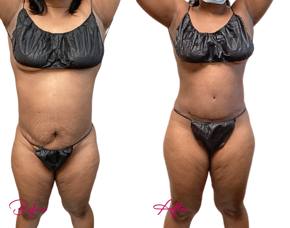 awake TUMMY - Case 5