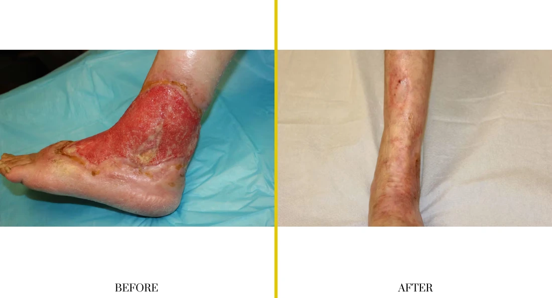 Extremity Reconstruction (17)