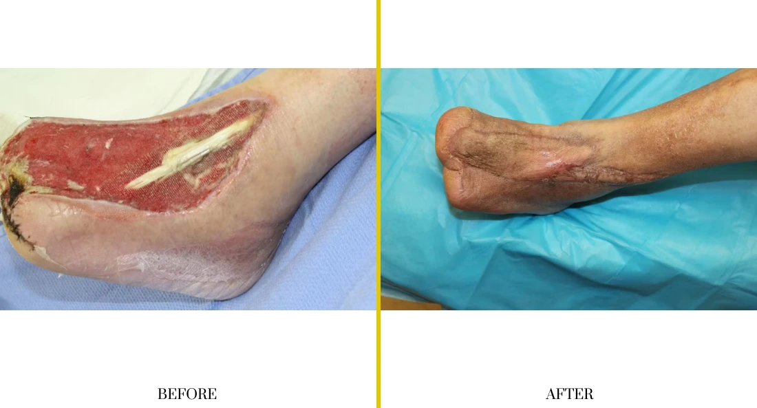Extremity Reconstruction (4)