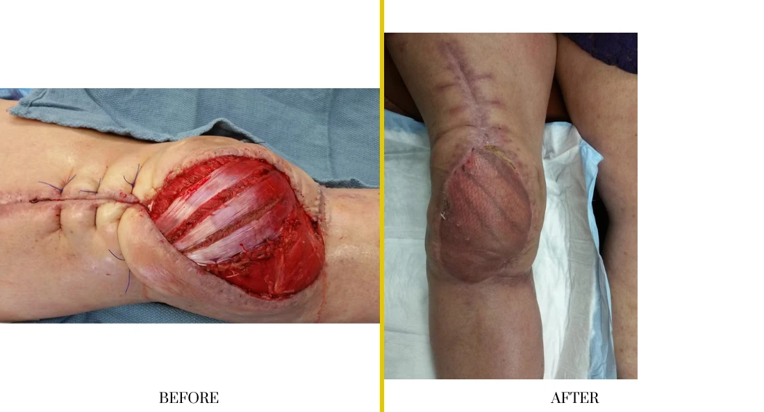 Extremity Reconstruction (40)