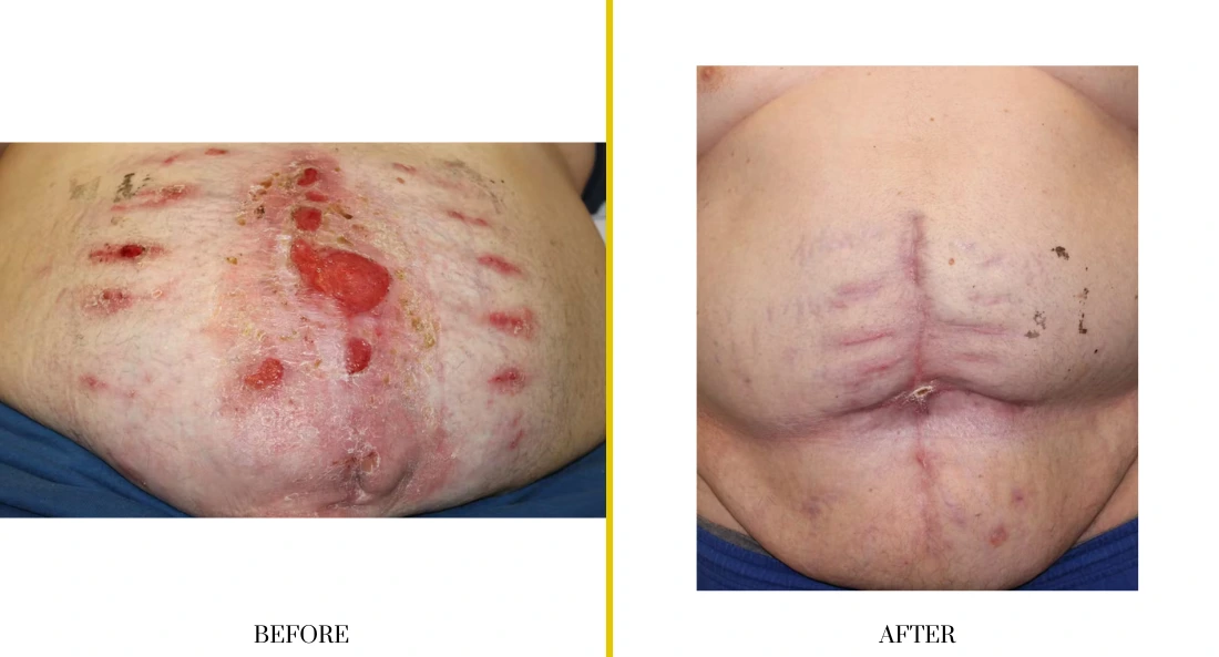 Extremity Reconstruction (66)