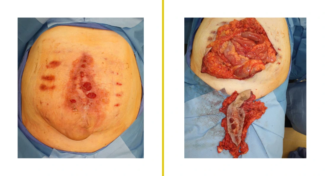 Extremity Reconstruction (67)