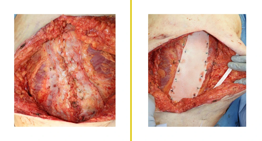 Extremity Reconstruction (68)