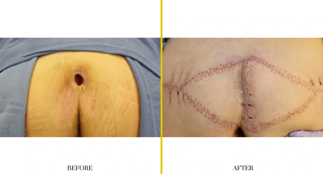 Extremity Reconstruction (72)