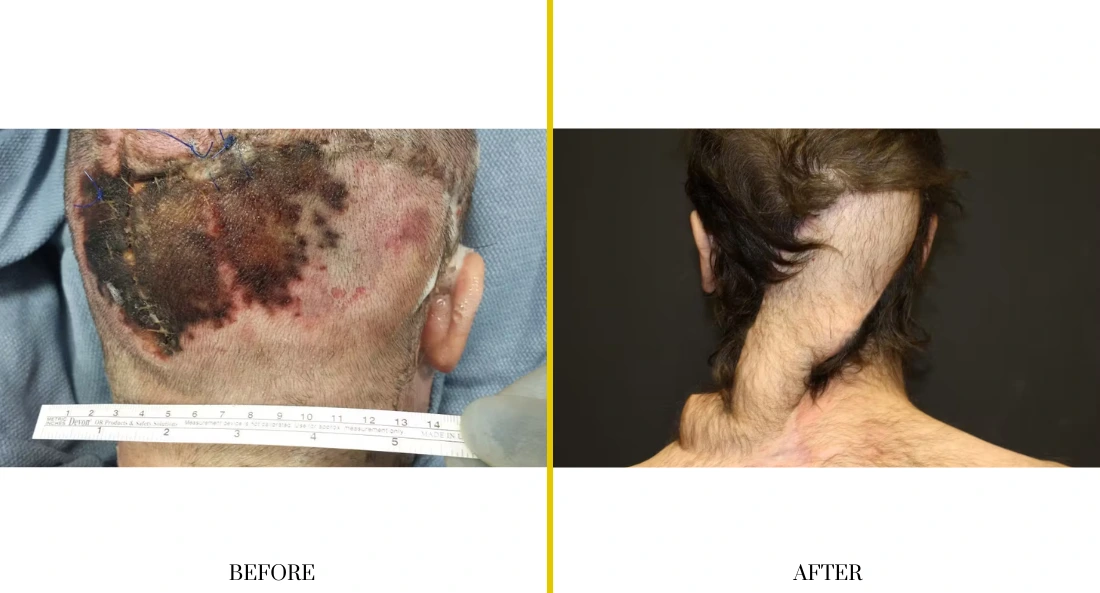 Extremity Reconstruction (73)