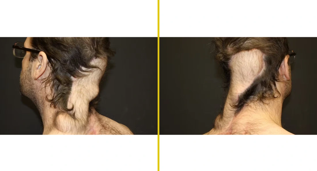 Extremity Reconstruction (74)