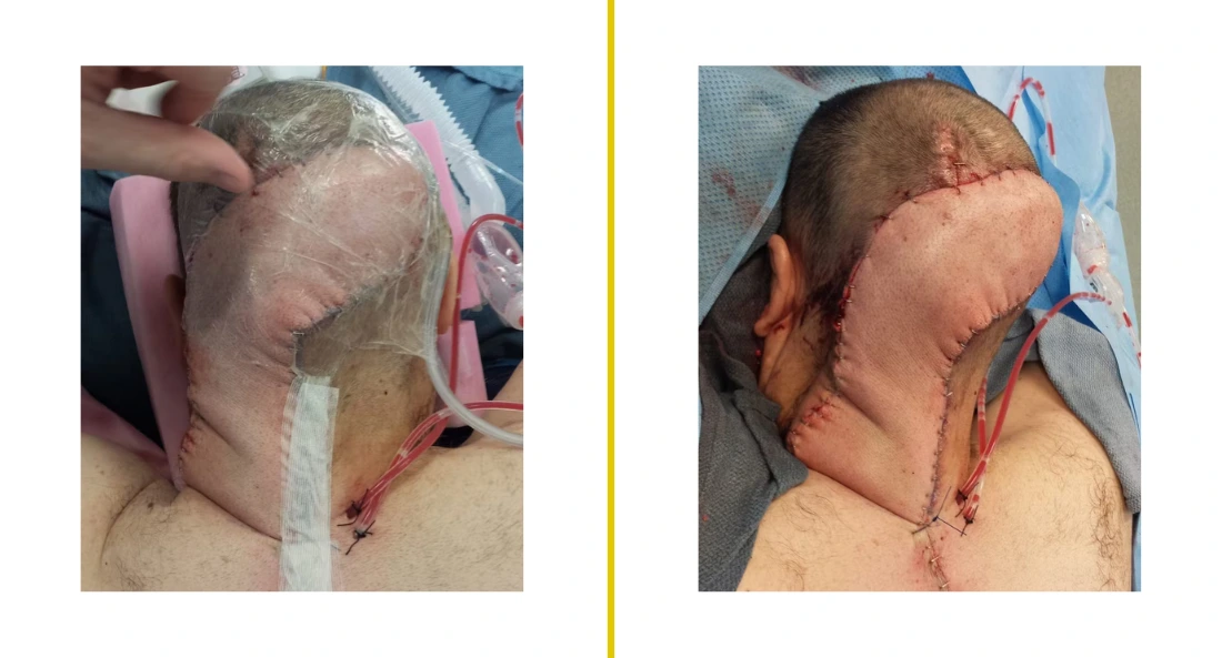 Extremity Reconstruction (75)