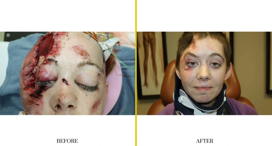 Extremity Reconstruction (76)