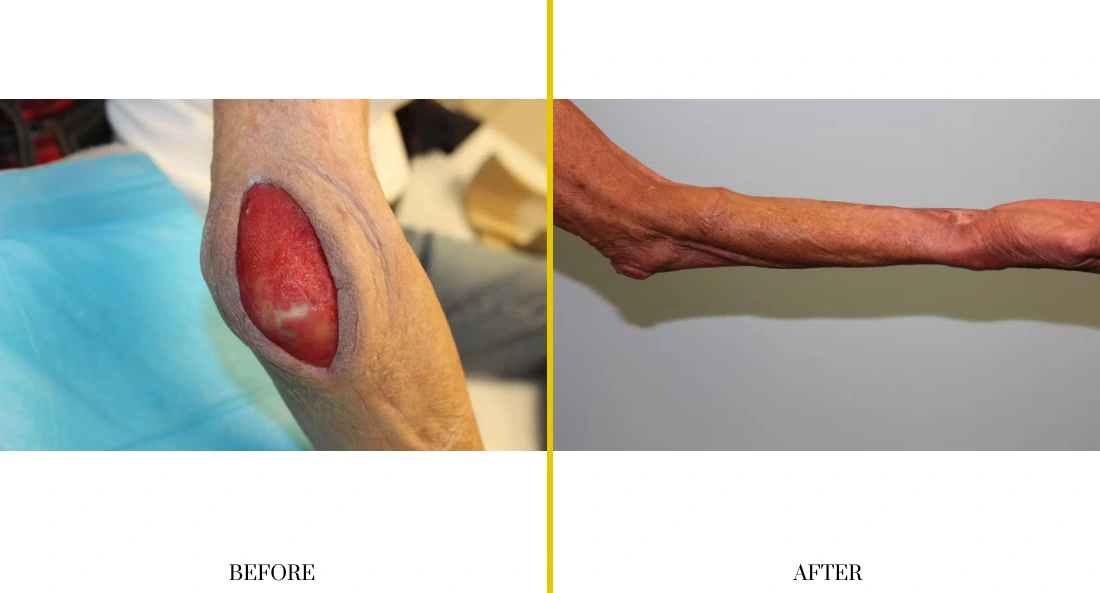 Extremity Reconstruction (9)