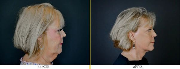 Regency Before & After (602 x 230 px)