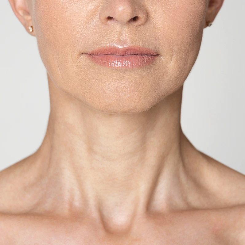 Neck Lift in Phoenix, AZ Banner