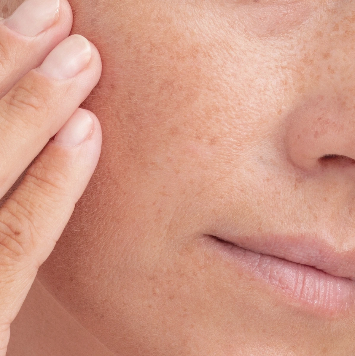 Brown Spot Treatment in Phoenix, AZ Banner