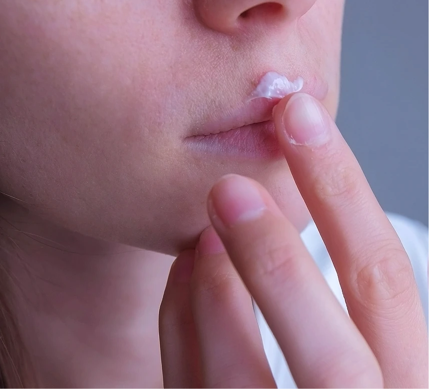 Herpes Care in Phoenix, AZ Banner