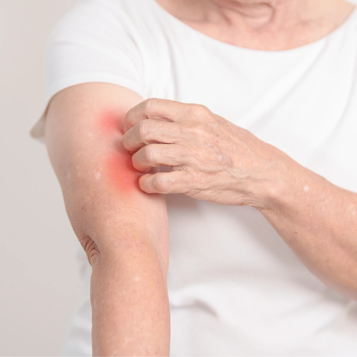 Lupus Treatment in Phoenix, AZ Banner