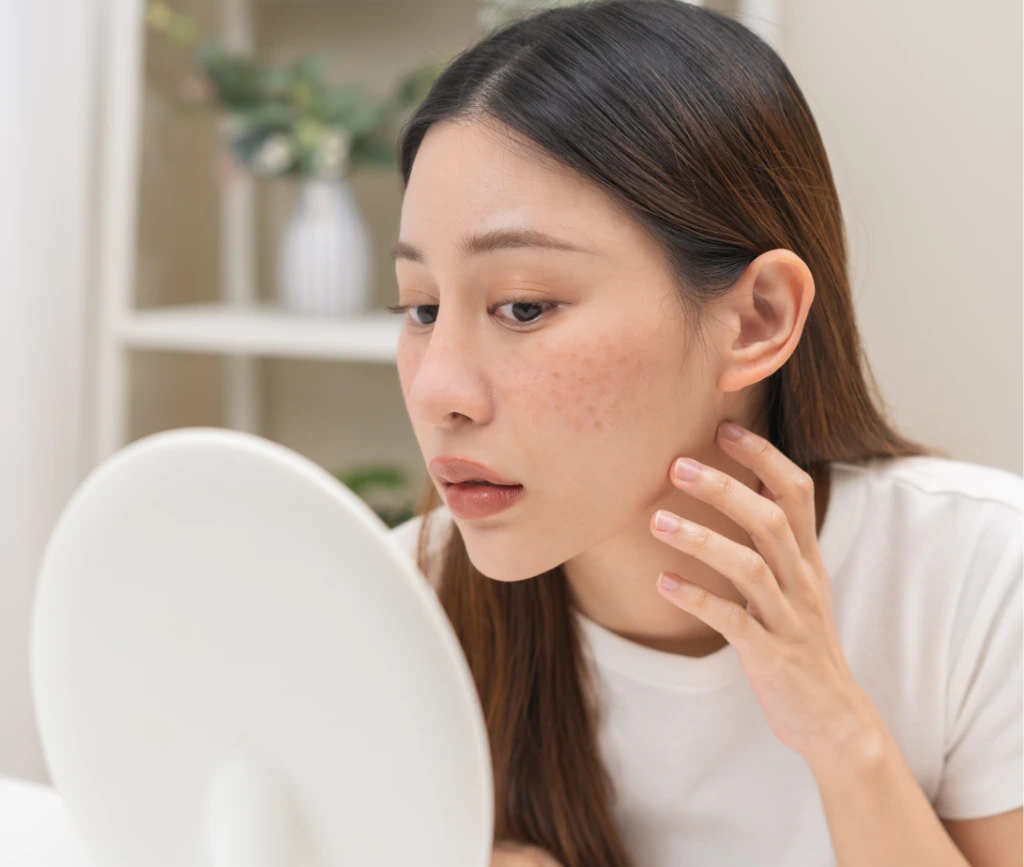 Melasma Treatment Phoenix, AZ Banner