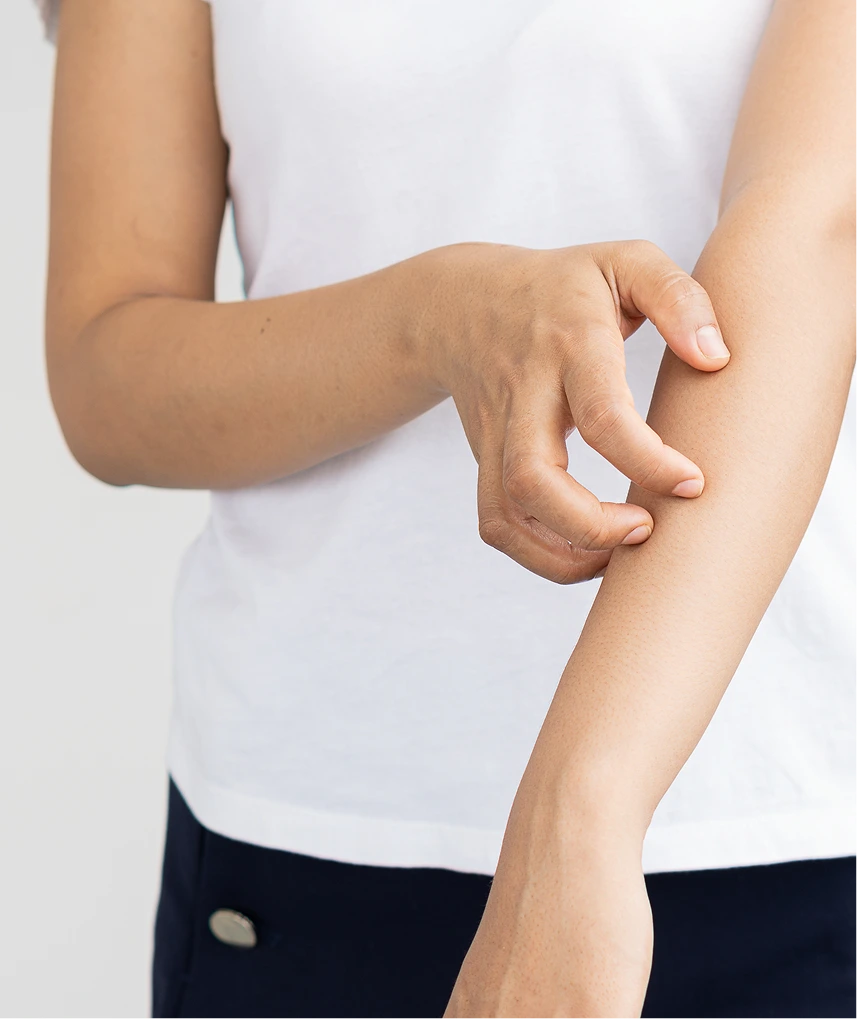 Person in white shirt touching their arm with visible skin irritation