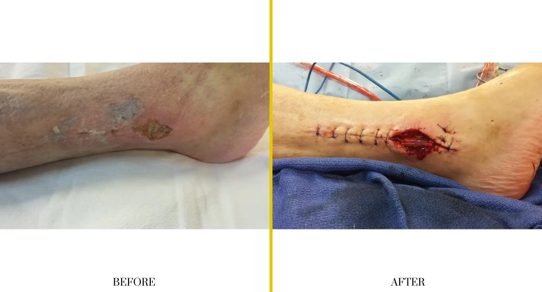 Extremity Reconstruction (43)