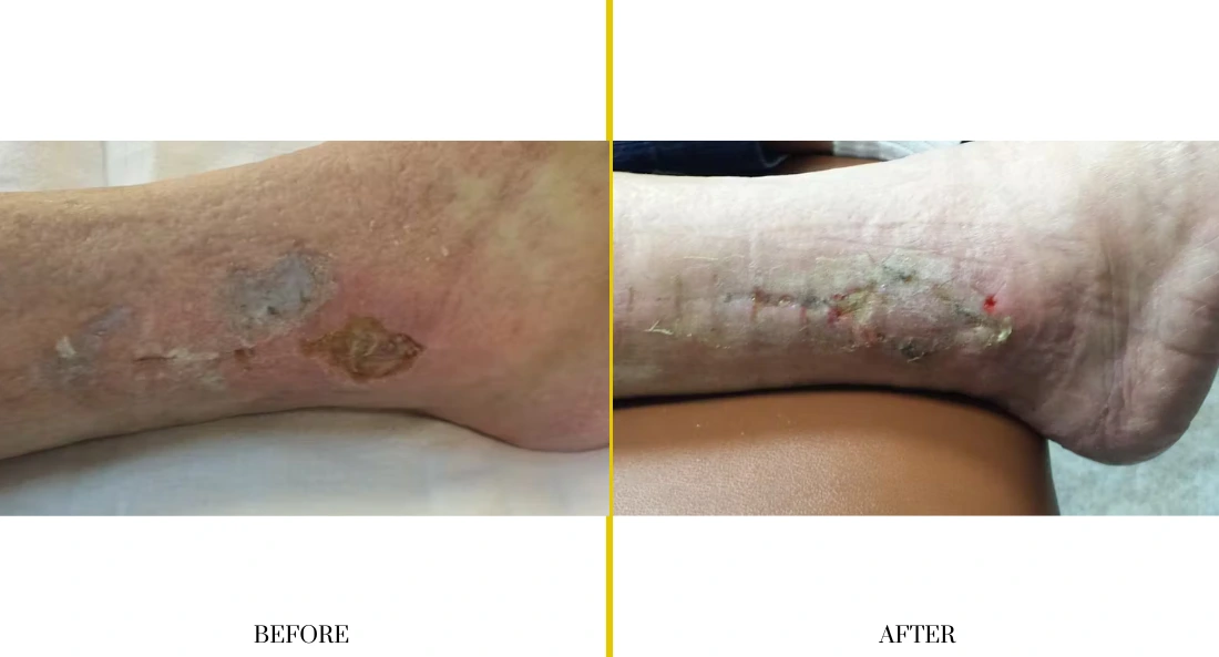 Extremity Reconstruction (45)