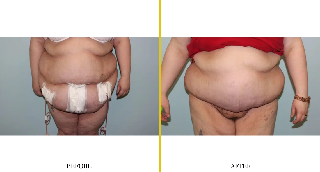 Extremity Reconstruction (63)