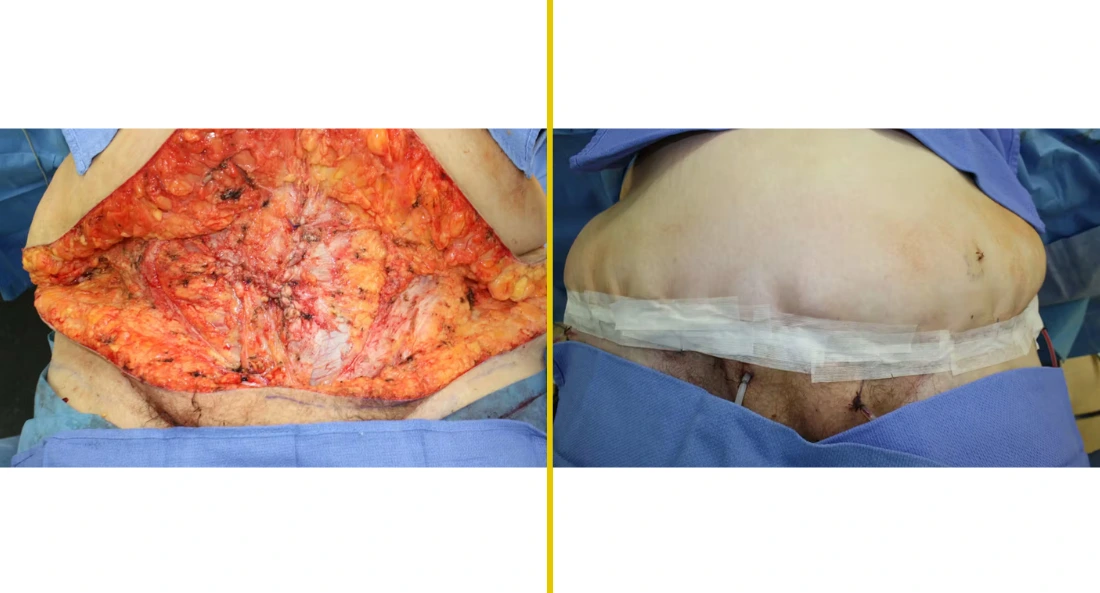 Extremity Reconstruction (64)