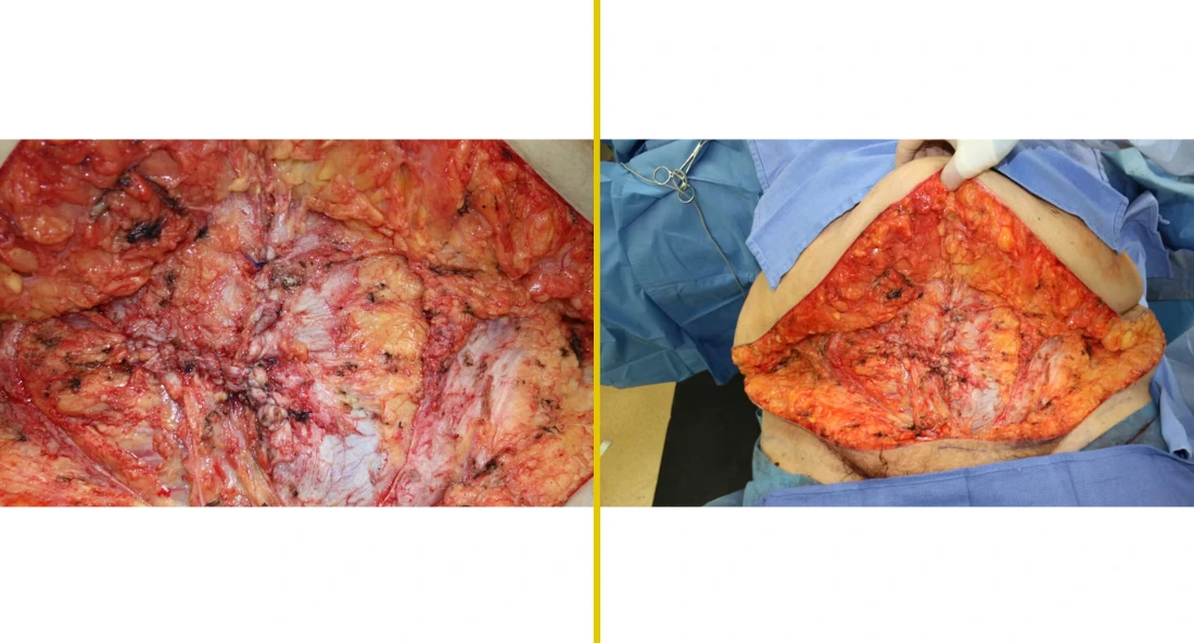 Extremity Reconstruction (65)