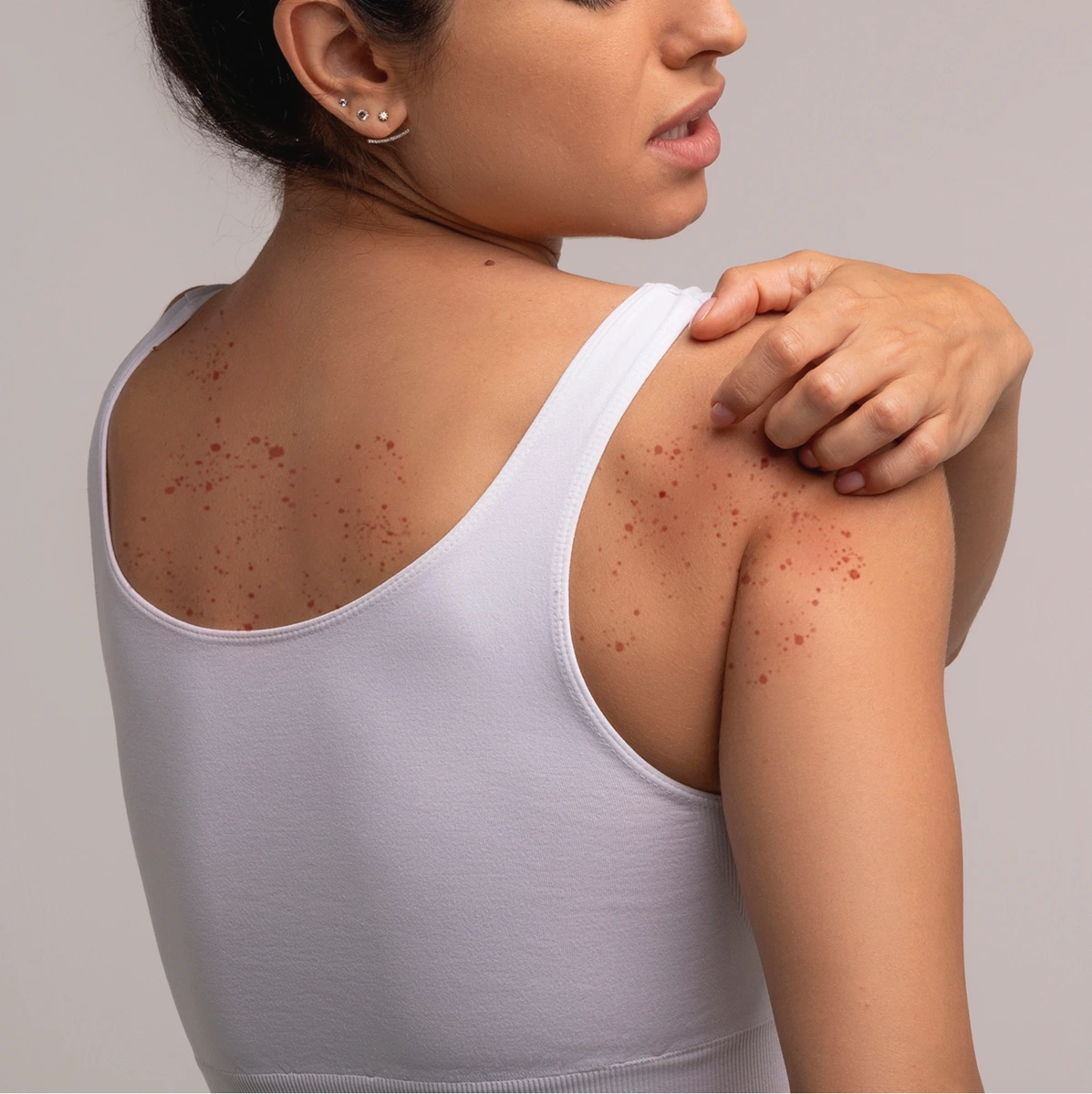 Dermatitis Treatment in Phoenix, AZ Banner