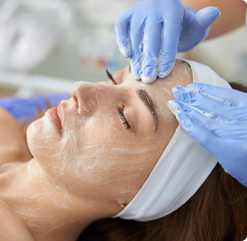 About Chemical Peel Banner