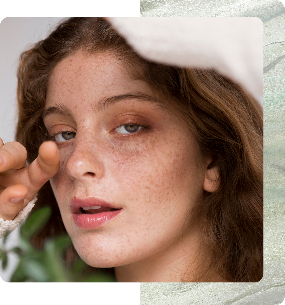 Melasma Solutions in Boston, MA Banner