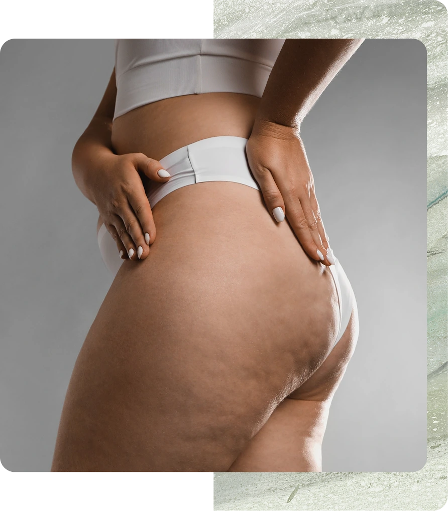 Person's hands examining buttocks and thighs from behind, wearing white briefs
