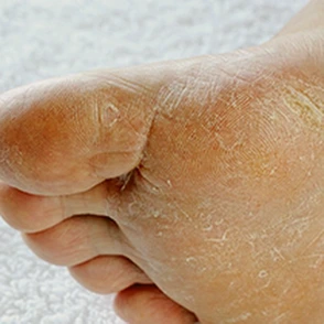 Athletes Foot Banner