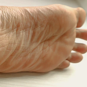 General Sole pain Banner