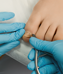 Ingrown Nail Treatment Banner