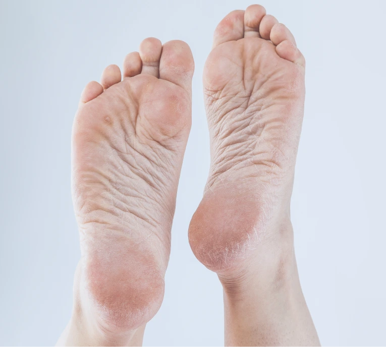 About Foot Corn Banner