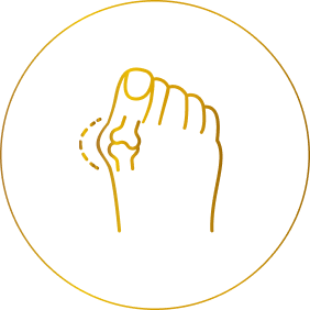 Candidates for Bunion Surgery: Progressively Worsening Banner